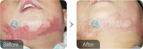 ���ݷ���Ƥ����ҽԺ