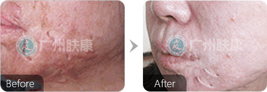 ���ݷ���Ƥ����ҽԺ