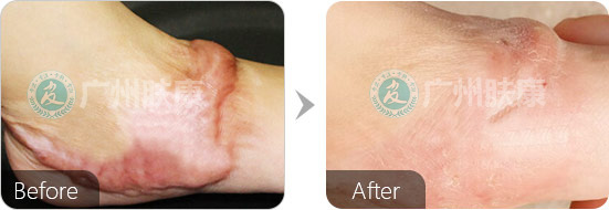 ���ݷ���Ƥ����ҽԺ