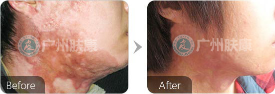 ���ݷ���Ƥ����ҽԺ