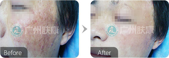 ���ݷ���Ƥ����ҽԺ