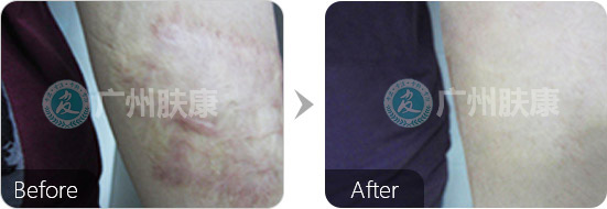 ���ݷ���Ƥ����ҽԺ