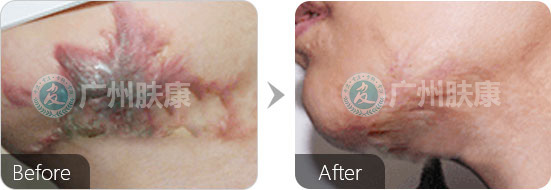 ���ݷ���Ƥ����ҽԺ