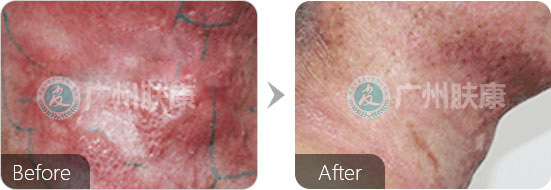 ���ݷ���Ƥ����ҽԺ