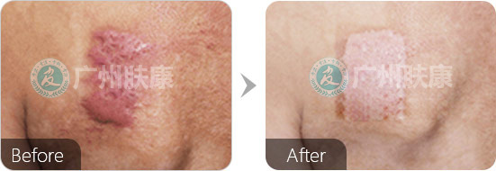 ���ݷ���Ƥ����ҽԺ