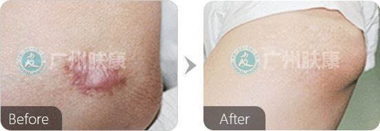 ���ݷ���Ƥ����ҽԺ