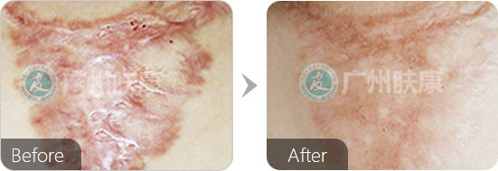 ���ݷ���Ƥ����ҽԺ