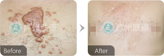 广州肤康皮肤病医院