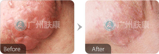 ���ݷ���Ƥ����ҽԺ