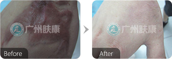 ���ݷ���Ƥ����ҽԺ