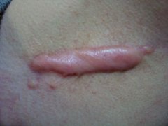 ݷƤҽԺ