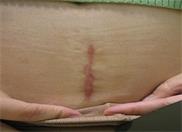 ���ݷ���Ƥ����ҽԺ