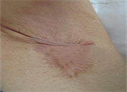 ���ݷ���Ƥ����ҽԺ