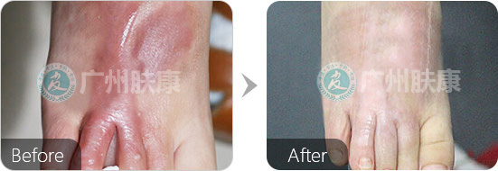 ���ݷ���Ƥ����ҽԺ