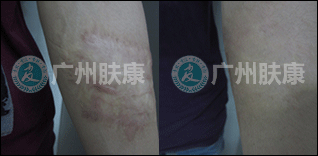 ���ݷ���Ƥ����ҽԺ