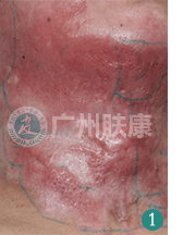 ���ݷ���Ƥ����ҽԺ