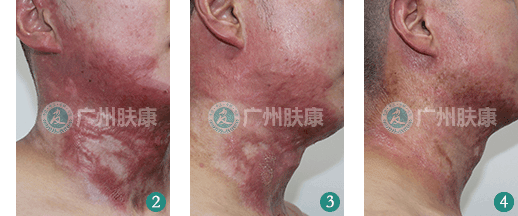 ���ݷ���Ƥ����ҽԺ