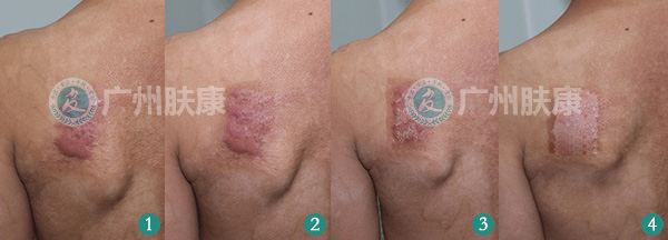 ���ݷ���Ƥ����ҽԺ