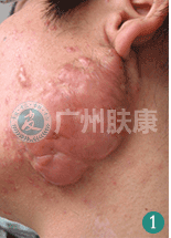 ���ݷ���Ƥ����ҽԺ