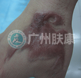 ���ݷ���Ƥ����ҽԺ