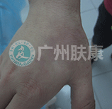 ���ݷ���Ƥ����ҽԺ