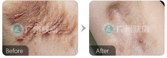 ���ݷ���Ƥ����ҽԺ