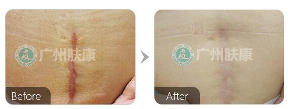 ���ݷ���Ƥ����ҽԺ