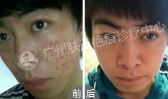 广州肤康皮肤病医院