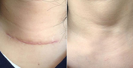 ���ݷ���Ƥ����ҽԺ