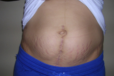 ���ݷ���Ƥ����ҽԺ