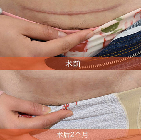 ���ݷ���Ƥ����ҽԺ