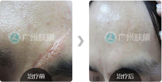 ���ݷ���Ƥ����ҽԺ