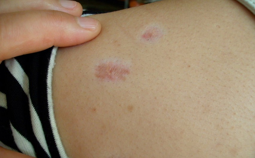 ���ݷ���Ƥ����ҽԺ