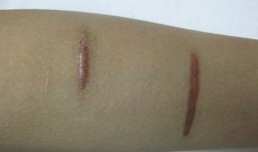 ���ݷ���Ƥ����ҽԺ