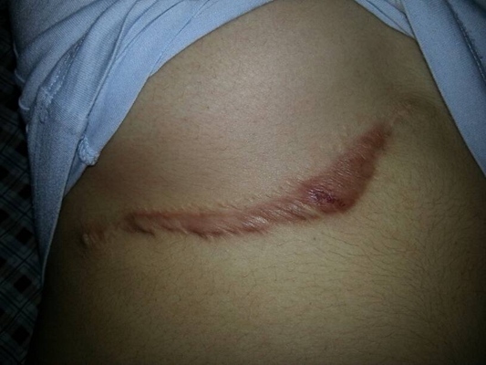 ���ݷ���Ƥ����ҽԺ