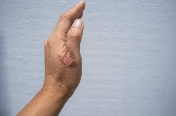 ���ݷ���Ƥ����ҽԺ