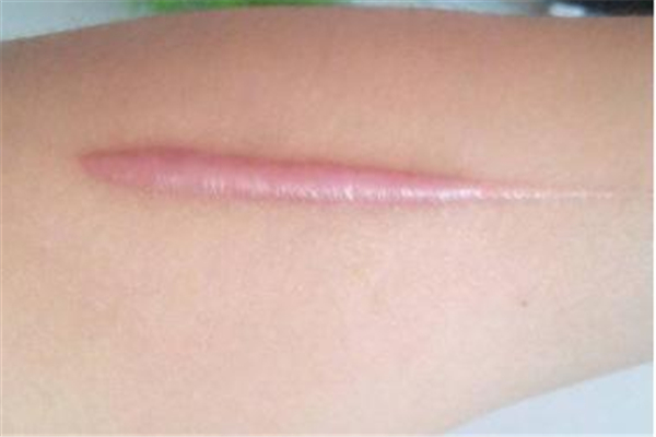 ���ݷ���Ƥ����ҽԺ