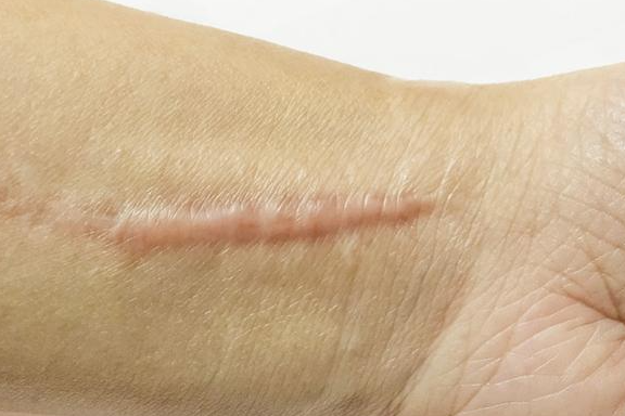 广州肤康皮肤病医院