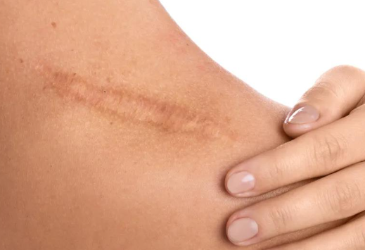 广州肤康皮肤病医院